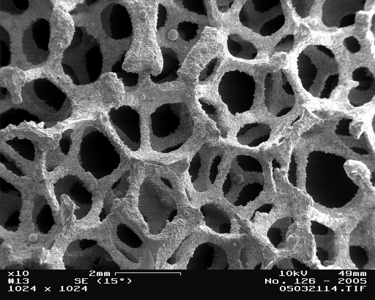 Foam cell - Wikipedia